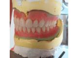 دندانسازی ولنجک
