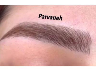 میکروبلیدینگ فیبروز ،حجیم سازی لب ، بن مژه 