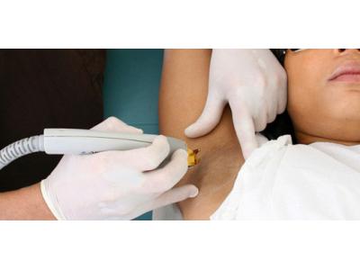 مرکز تخصصی لیزر  در محدوده شرق تهران 