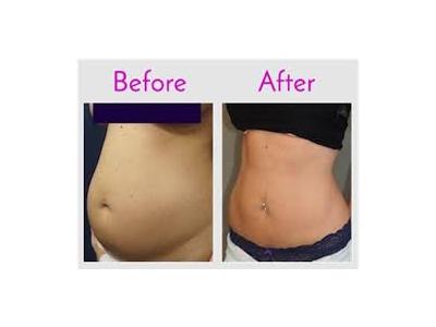 جراحی شکم و پهلو ، ماموپلاستی ، ابدومینوپلاستی و بلفاروپلاستی