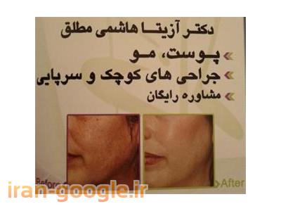 دکتر کاشت مو-جوانسازی پوست و رفع چین و چروک صورت ، مزوتراپی