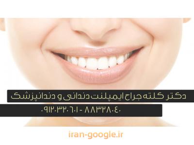 جراح دندان-جراح ایمپلنت های دندانی و دندانپزشک در تهران 