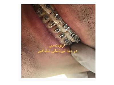 کلینیک تخصصی ایمپلنت  و کامپوزیت ونیر مشاهیر