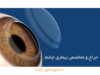 متخصص چشم پزشکی در تهران-متخصص چشم ، جراح و فوق تخصص قرنیه
