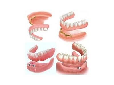 پروتز دندان-دکتر صابر رحیم زاده جراح و دندانپزشک در محدوده نارمک 