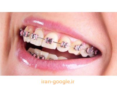 جراح و دندانپزشک زیبایی-جراح ایمپلنت در محدوده پاسداران 