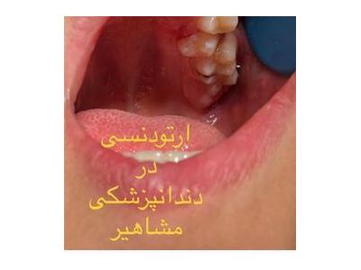 کلینیک تخصصی ایمپلنت  و کامپوزیت ونیر مشاهیر