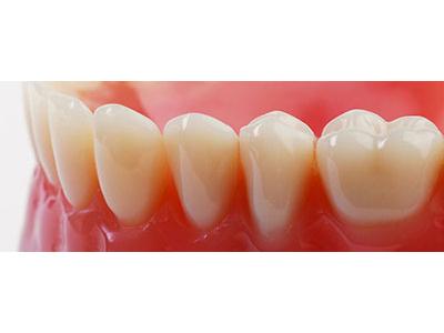 دندانسازي دانتين – لابراتور پروتزهای دندانی دانتین 