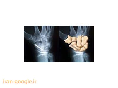 دکتر علی عالمی متخصص ارتوپدی و شکسته بندی 