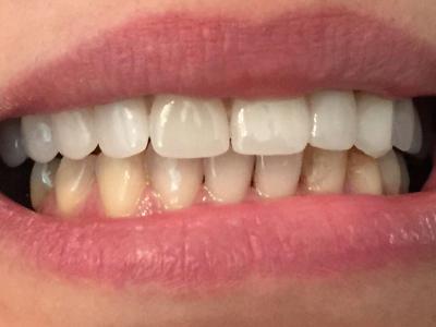 دندان پزشک-مرکز کاشت دندان و زیبایی