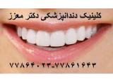 کلینیک دندانپزشکی دکتر محمدرضا معزز جراح ، دندانپزشک متخصص ایمپلنت در تهرانپارس