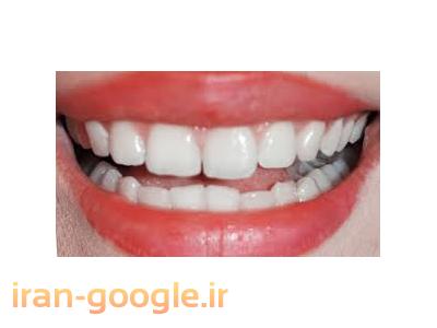 دندانپزشکی در تهران-مرکز تخصصی دندانپزشکی