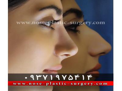 جراحی زیبایی-کلینیک جراحی بینی دکتر علی شهابی