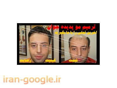 مرکز تخصصی کاشت و ترمیم مو پدیده جوان