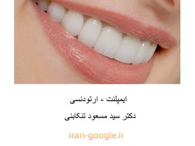 جراح ایمپلنت در محدوده پاسداران 