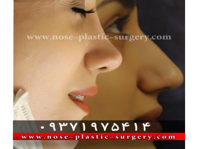 بینی-کلینیک جراحی بینی دکتر علی شهابی